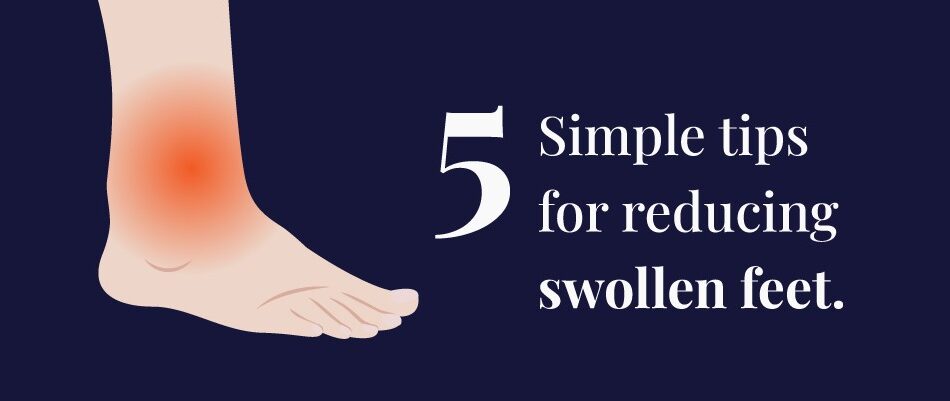 Obese And Swollen Feet